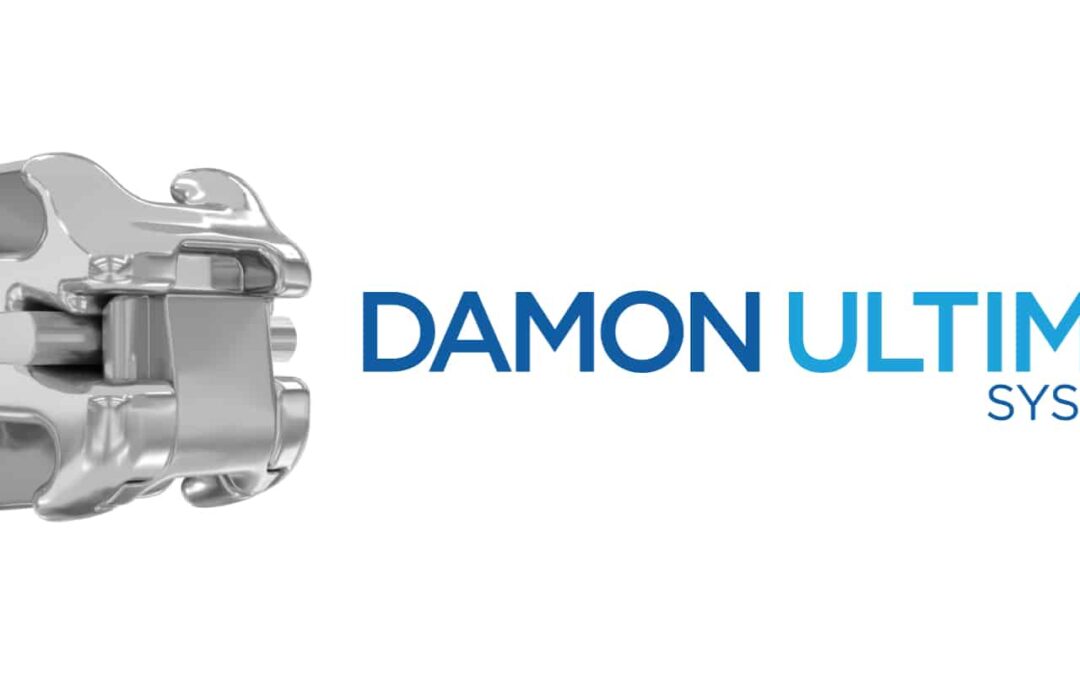 Damon Q i Damon Ultima sistem: Ortodontija koja radi s tvojim tijelom, ne protiv njega
